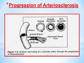 *Progression of Arteriosclerosis
 