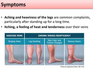 Arteriosclerosis and venous disease | PPTX
