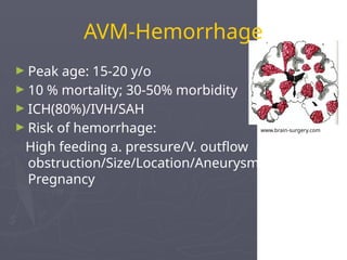 Arteriovenous Malformation Arteriovenous Malformation | PPTX