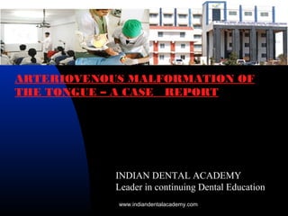 ARTERIOVENOUS MALFORMATION OF
THE TONGUE – A CASE REPORT
INDIAN DENTAL ACADEMY
Leader in continuing Dental Education
www.indiandentalacademy.com
 