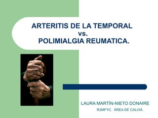 ARTERITIS DE LA TEMPORAL
vs.
POLIMIALGIA REUMATICA.
LAURA MARTÍN-NIETO DONAIRE
R3MFYC. ÀREA DE CALVIÀ.
 