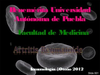 Benemérita Universidad
 Autónoma de P uebla
  Facultad de Medicina



     Inmunología |Otoño 2012
                               Slide 001
 