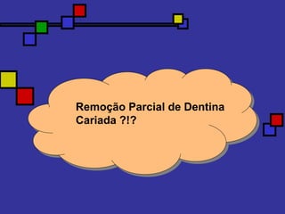 Remoção Parcial de Dentina
Cariada ?!?
 