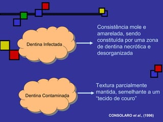 Dentina Infectada
Dentina Contaminada
Consistência mole e
amarelada, sendo
constituída por uma zona
de dentina necrótica e
desorganizada
Textura parcialmente
mantida, semelhante a um
“tecido de couro”
CONSOLARO et al., (1996)
 