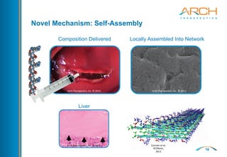 10
Liver
Arch	
  Therapeu,cs,	
  Inc.	
  ©	
  2014	
  
Arch	
  Therapeu,cs,	
  Inc.	
  ©	
  2014	
  
Novel Mechanism: Self-Assembly
Composition Delivered Locally Assembled Into Network
Arch	
  Therapeu,cs,	
  Inc.	
  	
  ©	
  2014	
  
Arch	
  Therapeu,cs,	
  Inc.	
  ©	
  2015	
  
Cormier	
  et	
  al,	
  
ACSNano,	
   	
  	
  
2013	
  
 