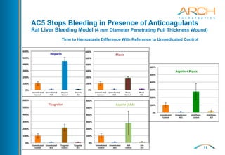 11
0%	
  
100%	
  
200%	
  
300%	
  
400%	
  
500%	
  
600%	
  
Unmedicated	
  
Control	
  
Unmedicated	
  	
  	
  	
  	
  	
  	
  	
  	
  	
  	
  	
  	
  	
  	
  	
  
AC5	
  
Heparin	
  	
  	
  	
  	
  	
  	
  	
  	
  	
  	
  	
  	
  	
  	
  	
  	
  	
  	
  	
  	
  	
  	
  	
  
Control	
  
Heparin	
  	
  	
  	
  	
  	
  	
  	
  	
  	
  	
  	
  	
  	
  	
  	
  	
  	
  	
  	
  	
  	
  	
  
AC5	
  
Heparin	
  
0%	
  
100%	
  
200%	
  
300%	
  
400%	
  
500%	
  
600%	
  
Unmedicated	
  
Control	
  
Unmedicated	
  	
  	
  	
  	
  	
  	
  	
  	
  	
  	
  
AC5	
  
Ticagrelor	
  	
  	
  	
  	
  	
  	
  	
  	
  	
  	
  	
  	
  	
  	
  
Control	
  
Ticagrelor	
  	
  	
  	
  	
  	
  	
  	
  	
  	
  	
  	
  	
  	
  	
  	
  	
  	
  	
  	
  
AC5	
  
Ticagrelor	
  	
  
0%	
  
100%	
  
200%	
  
300%	
  
400%	
  
500%	
  
600%	
  
Unmedicated	
  
Control	
  
Unmedicated	
  	
  	
  	
  	
  	
  	
  	
  	
  	
  	
  	
  	
  	
  
AC5	
  
Plavix	
  	
  	
  	
  	
  	
  	
  	
  	
  	
  	
  	
  	
  	
  	
  	
  	
  	
  	
  	
  	
  	
  	
  
Control	
  
Plavix	
  	
  	
  	
  	
  	
  	
  	
  	
  	
  	
  	
  	
  	
  	
  	
  	
  	
  	
  	
  	
  	
  	
  	
  	
  	
  	
  
AC5	
  
Plavix	
  
0%	
  
100%	
  
200%	
  
300%	
  
400%	
  
500%	
  
600%	
  
Unmedicated	
  
Control	
  
Unmedicated	
  	
  	
  	
  	
  	
  	
  	
  	
  	
  	
  	
  
AC5	
  
ASA	
  	
  	
  	
  	
  	
  	
  	
  	
  	
  	
  	
  	
  	
  	
  	
  	
  	
  	
  	
  	
  	
  	
  	
  	
  
Control	
  
ASA	
  	
  	
  	
  	
  	
  	
  	
  	
  	
  	
  	
  	
  	
  	
  	
  	
  	
  	
  	
  	
  	
  	
  	
  	
  	
  	
  	
  	
  	
  
AC5	
  
Aspirin	
  (ASA)	
  
0%	
  
100%	
  
200%	
  
300%	
  
400%	
  
500%	
  
600%	
  
Unmedicated	
  
Control	
  
Unmedicated	
  	
  	
  	
  	
  	
  	
  	
  	
  	
  	
  
AC5	
  
ASA/Plavix	
  	
  	
  	
  	
  	
  	
  	
  	
  	
  	
  	
  	
  	
  
Control	
  
ASA/Plavix	
  	
  	
  	
  	
  	
  	
  	
  	
  	
  	
  	
  	
  	
  	
  	
  	
  	
  
AC5	
  
Aspirin	
  +	
  Plavix	
  
AC5 Stops Bleeding in Presence of Anticoagulants
Rat Liver Bleeding Model (4 mm Diameter Penetrating Full Thickness Wound)
Time to Hemostasis Difference With Reference to Unmedicated Control
 
