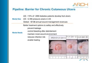 14
Market Size
US: ~15% of ~26M diabetes patients develop foot ulcers
US: ~2.5M pressure ulcers in US
Global: ~$13B annual wound management revenues
Market Needs
Better treatment options to safely and effectively
prevent leakage
control bleeding after debridement
maintain moist wound environment
reduces infection risk
enable healing
Pipeline: Barrier for Chronic Cutaneous Ulcers
 