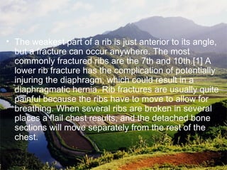 • The weakest part of a rib is just anterior to its angle,
but a fracture can occur anywhere. The most
commonly fractured ribs are the 7th and 10th.[1] A
lower rib fracture has the complication of potentially
injuring the diaphragm, which could result in a
diaphragmatic hernia. Rib fractures are usually quite
painful because the ribs have to move to allow for
breathing. When several ribs are broken in several
places a flail chest results, and the detached bone
sections will move separately from the rest of the
chest.
 