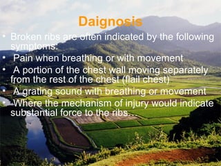 Daignosis
• Broken ribs are often indicated by the following 
symptoms:
•  Pain when breathing or with movement
•  A portion of the chest wall moving separately 
from the rest of the chest (flail chest)
•  A grating sound with breathing or movement
•  Where the mechanism of injury would indicate 
substantial force to the ribs…
 
