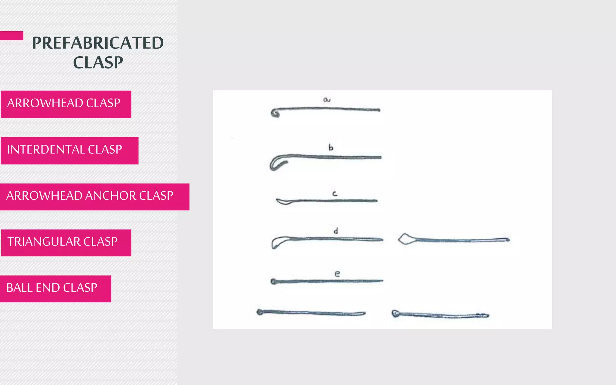 PREFABRICATED
CLASP
ARROWHEADCLASP
INTERDENTALCLASP
ARROWHEADANCHORCLASP
TRIANGULARCLASP
BALLENDCLASP
 