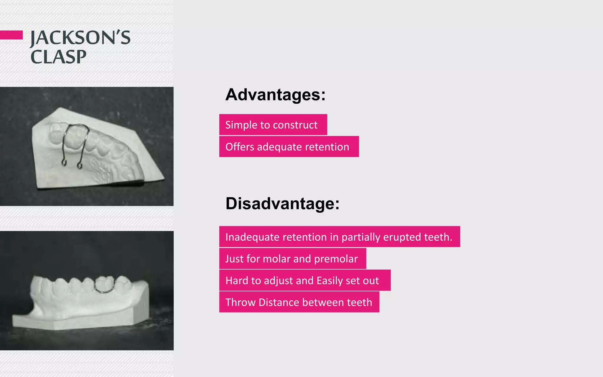 JACKSON’S
CLASP
Advantages:
Disadvantage:
Simple to construct
Offers adequate retention
Inadequate retention in partially erupted teeth.
Just for molar and premolar
Hard to adjust and Easily set out
Throw Distance between teeth
 