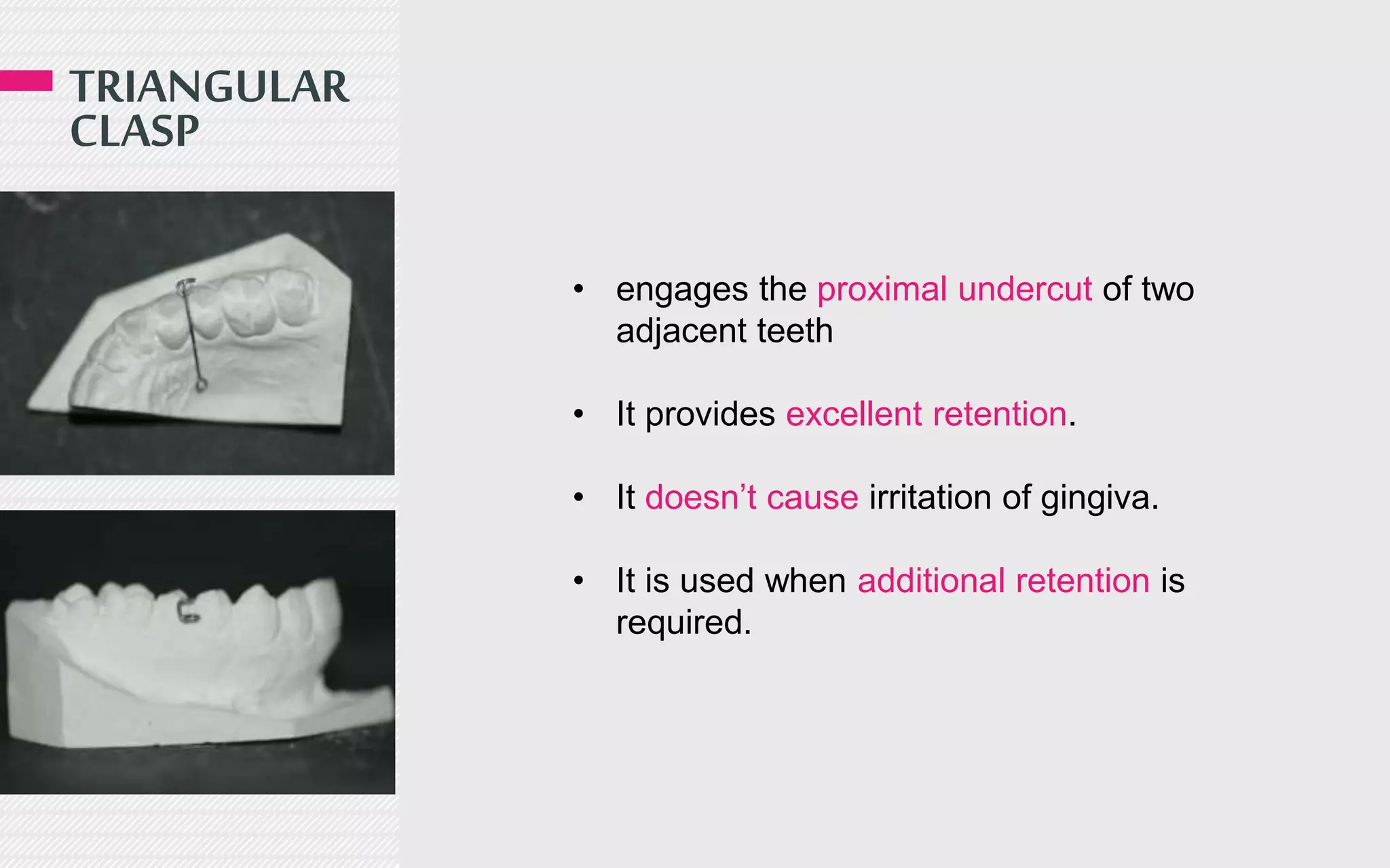 TRIANGULAR
CLASP
• engages the proximal undercut of two
adjacent teeth
• It provides excellent retention.
• It doesn’t cause irritation of gingiva.
• It is used when additional retention is
required.
 