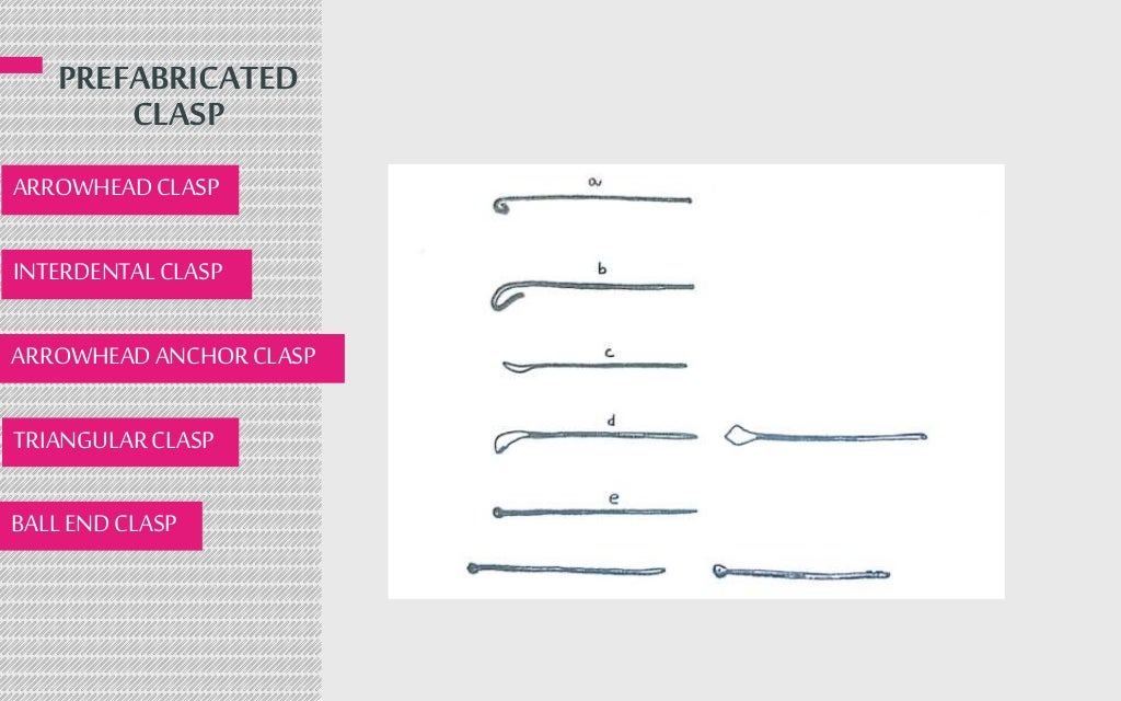clasps in removable orthodontic appliance