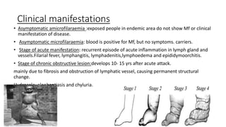 Clinical manifestations
• Asymptomatic amicrofilaraemia :exposed people in endemic area do not show Mf or clinical
manifestation of disease.
• Asymptomatic microfilaraemia: blood is positive for Mf, but no symptoms. carriers.
• Stage of acute manifestation: recurrent episode of acute inflammation in lymph gland and
vessels.Filarial fever, lymphangitis, lymphadenitis,lymphoedema and epididymoorchitis.
• Stage of chronic obstructive lesion:develops 10- 15 yrs after acute attack.
mainly due to fibrosis and obstruction of lymphatic vessel, causing permanent structural
change.
Hydrocele, elephantiasis and chyluria.
 