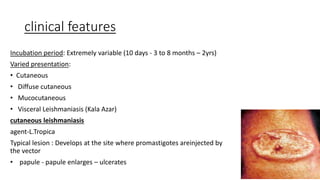 clinical features
Incubation period: Extremely variable (10 days - 3 to 8 months – 2yrs)
Varied presentation:
• Cutaneous
• Diffuse cutaneous
• Mucocutaneous
• Visceral Leishmaniasis (Kala Azar)
cutaneous leishmaniasis
agent-L.Tropica
Typical lesion : Develops at the site where promastigotes areinjected by
the vector
• papule - papule enlarges – ulcerates
 
