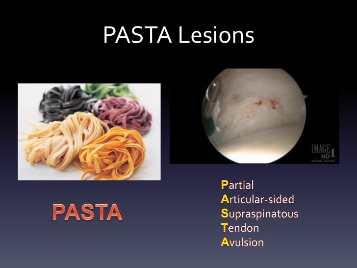 PASTA Repair