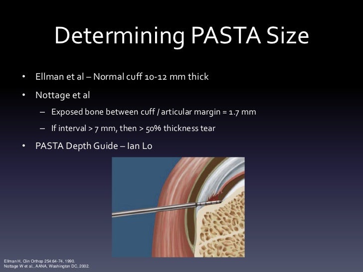 PASTA Repair