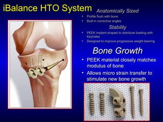 iBalanceiBalance HTO SystemHTO System Anatomically SizedAnatomically Sized
• Profile flush with boneProfile flush with bone
• Built in corrective anglesBuilt in corrective angles
StabilityStability
• PEEK implant shaped to distribute loading withPEEK implant shaped to distribute loading with
KeyholesKeyholes
• Designed to improve progressive weight bearingDesigned to improve progressive weight bearing
Bone GrowthBone Growth
• PEEK material closely matchesPEEK material closely matches
modulus of bonemodulus of bone
• Allows micro strain transfer toAllows micro strain transfer to
stimulate new bone growthstimulate new bone growth
 