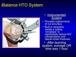 iBalanceiBalance HTO SystemHTO System
• InstrumentedInstrumented
SystemSystem
• Provides highest levelProvides highest level
of cut accuracyof cut accuracy
• Built in retractorsBuilt in retractors
create a cuttingcreate a cutting
“envelope” to“envelope” to
significantly reduce N/Vsignificantly reduce N/V
complications andcomplications and
lateral cortex fractureslateral cortex fractures
• After learningAfter learning
system, average ORsystem, average OR
time was 1 hourtime was 1 hour
 