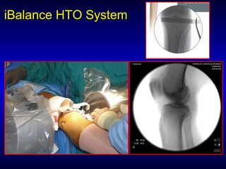 iBalanceiBalance HTO SystemHTO System
 