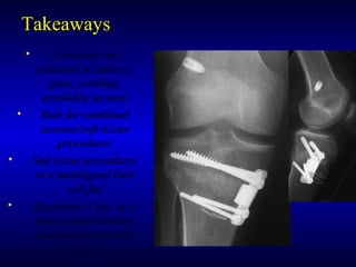 TakeawaysTakeaways
• Osteotomy hasOsteotomy has
potential to addresspotential to address
pain, swelling,pain, swelling,
instability at onceinstability at once
• Role for combinedRole for combined
osseous/soft tissueosseous/soft tissue
proceduresprocedures
• Soft tissue proceduresSoft tissue procedures
in a malaligned limbin a malaligned limb
will failwill fail
• Alignment is key, as isAlignment is key, as is
preop understandingpreop understanding
and plan for desiredand plan for desired
changeschanges
 