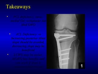 TakeawaysTakeaways
• PCL deficiency, varus,PCL deficiency, varus,
medial OAmedial OA →→ biplanar Antbiplanar Ant
Med OWOMed OWO
• ACL DeficiencyACL Deficiency →→
Increasing posterior tibialIncreasing posterior tibial
slope should be avoided,slope should be avoided,
decreasing slope may bedecreasing slope may be
beneficialbeneficial
• LCWO may be easier,LCWO may be easier,
MOWO has benefits andMOWO has benefits and
can work if slope iscan work if slope is
maintained/decreasedmaintained/decreased
 