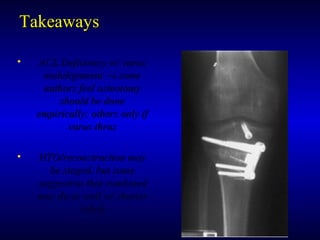 TakeawaysTakeaways
• ACL Deficiency w/ varusACL Deficiency w/ varus
malalignmentmalalignment →→ somesome
authors feel osteotomyauthors feel osteotomy
should be doneshould be done
empirically; others only ifempirically; others only if
varus thrusvarus thrus
• HTO/reconstruction mayHTO/reconstruction may
be staged, but somebe staged, but some
suggestion that combinedsuggestion that combined
may do as well w/ shortermay do as well w/ shorter
rehabrehab
 