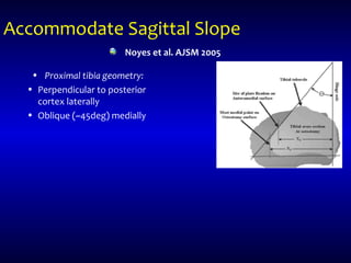 Accommodate Sagittal Slope
• Proximal tibia geometry:
• Perpendicular to posterior
cortex laterally
• Oblique (~45deg) medially
Noyes et al. AJSM 2005
 