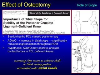• Sectioning the PCL caused posterior sagSectioning the PCL caused posterior sag
• AOWOAOWO →→ increase in tibial slopeincrease in tibial slope →→ significantlysignificantly
reduced sag/translation throughout ROMreduced sag/translation throughout ROM
• Hypothesis: AOWO may improve articularHypothesis: AOWO may improve articular
contact forces in PCL deficient kneescontact forces in PCL deficient knees
Effect of OsteotomyEffect of Osteotomy
increasing slope causes an anterior shift
in tibial resting position
accentuated under axial loads
Role of Slope
 