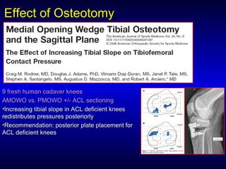 Effect of OsteotomyEffect of Osteotomy
9 fresh human cadaver knees9 fresh human cadaver knees
AMOWO vs. PMOWO +/- ACL sectioningAMOWO vs. PMOWO +/- ACL sectioning
•Increasing tibial slope in ACL deficient kneesIncreasing tibial slope in ACL deficient knees
redistributes pressures posteriorlyredistributes pressures posteriorly
•Recommendation: posterior plate placement forRecommendation: posterior plate placement for
ACL deficient kneesACL deficient knees
 