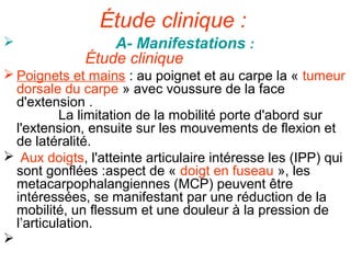 Étude clinique :
                 A- Manifestations :
              Étude clinique
 Poignets et mains : au poignet et au carpe la « tumeur
  dorsale du carpe » avec voussure de la face
  d'extension .
           La limitation de la mobilité porte d'abord sur
  l'extension, ensuite sur les mouvements de flexion et
  de latéralité.
 Aux doigts, l'atteinte articulaire intéresse les (IPP) qui
  sont gonflées :aspect de « doigt en fuseau », les
  metacarpophalangiennes (MCP) peuvent être
  intéressées, se manifestant par une réduction de la
  mobilité, un flessum et une douleur à la pression de
  l’articulation.

 