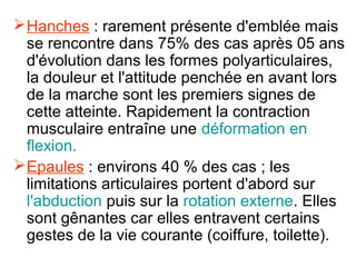  Hanches : rarement présente d'emblée mais
  se rencontre dans 75% des cas après 05 ans
  d'évolution dans les formes polyarticulaires,
  la douleur et l'attitude penchée en avant lors
  de la marche sont les premiers signes de
  cette atteinte. Rapidement la contraction
  musculaire entraîne une déformation en
  flexion.
 Epaules : environs 40 % des cas ; les
  limitations articulaires portent d'abord sur
  l'abduction puis sur la rotation externe. Elles
  sont gênantes car elles entravent certains
  gestes de la vie courante (coiffure, toilette).
 