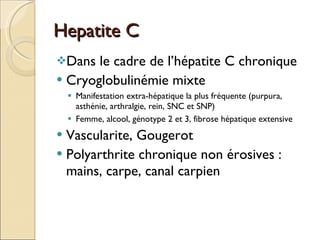 Hepatite C Dans le cadre de l’hépatite C chronique Cryoglobulinémie mixte Manifestation extra-hépatique la plus fréquente (purpura, asthénie, arthralgie, rein, SNC et SNP) Femme, alcool, génotype 2 et 3, fibrose hépatique extensive Vascularite, Gougerot Polyarthrite chronique non érosives :  mains, carpe, canal carpien 