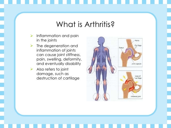 Arthritic Nutrition