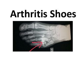 Arthritis Shoes
 