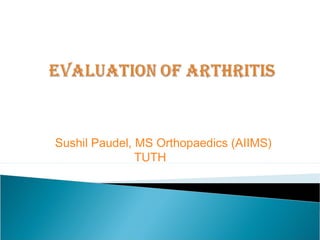 Sushil Paudel, MS Orthopaedics (AIIMS)
TUTH
 