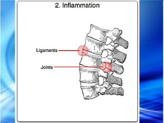 Rheumatoid Arthritis
◦ Symmetric
◦ PIP, MCP, not distal
◦ Ulnar deviation,
swan neck
deformities
◦ Rheumatoid nodules
 ...