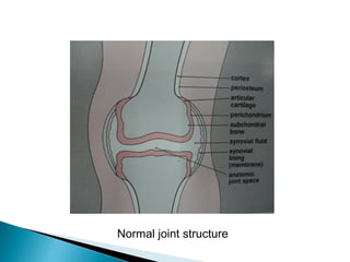 Normal joint structure
 