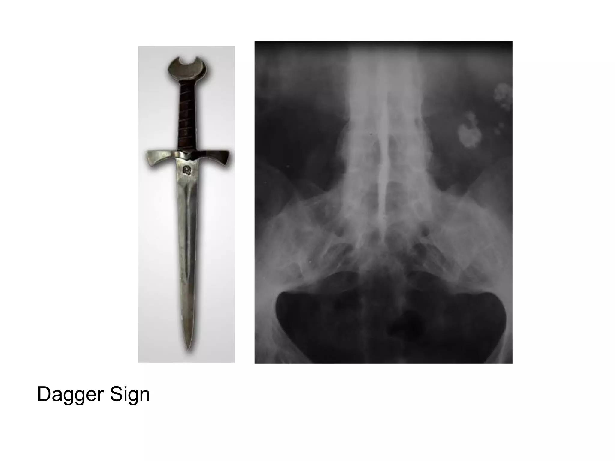 Dagger Sign
 