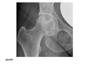 Diagnostic Imaging of Arthritis | PPT
