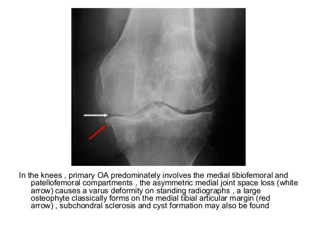 Diagnostic Imaging of Arthritis
