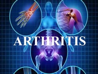 ARTHRITIS
 