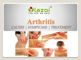 Arthritis
CAUSES | SYMPTOMS | TREATMENT
 