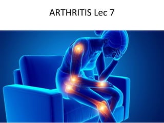 ARTHRITIS Lec 7
 