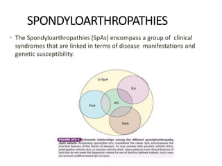 SPONDYLOARTHROPATHIES
• The Spondyloarthropathies (SpAs) encompass a group of clinical
syndromes that are linked in terms of disease manifestations and
genetic susceptibility.
 
