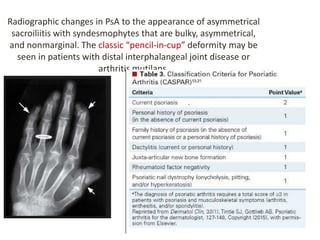 Radiographic changes in PsA to the appearance of asymmetrical
sacroiliitis with syndesmophytes that are bulky, asymmetrical,
and nonmarginal. The classic “pencil-in-cup” deformity may be
seen in patients with distal interphalangeal joint disease or
arthritis mutilans.
 