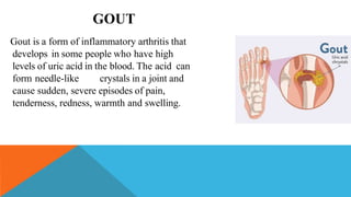 presentation on arthritis | PPTX