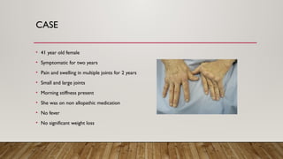CASE
• 41 year old female
• Symptomatic for two years
• Pain and swelling in multiple joints for 2 years
• Small and large joints
• Morning stiffness present
• She was on non allopathic medication
• No fever
• No significant weight loss
 