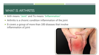 Arthritis and its types