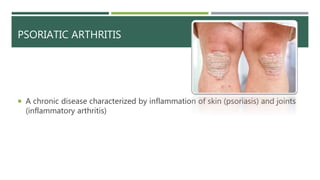 Arthritis and its types